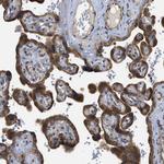 PERK Antibody in Immunohistochemistry (Paraffin) (IHC (P))