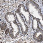 PERK Antibody in Immunohistochemistry (Paraffin) (IHC (P))