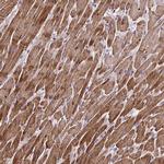 Cardiac Troponin T Antibody in Immunohistochemistry (Paraffin) (IHC (P))