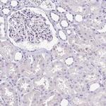 Cardiac Troponin T Antibody in Immunohistochemistry (Paraffin) (IHC (P))