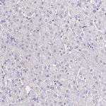 Cardiac Troponin T Antibody in Immunohistochemistry (Paraffin) (IHC (P))