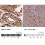 XPR1 Antibody