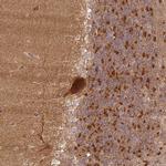 XPR1 Antibody in Immunohistochemistry (Paraffin) (IHC (P))