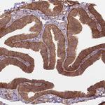 XPR1 Antibody in Immunohistochemistry (Paraffin) (IHC (P))