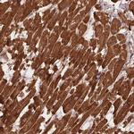 XPR1 Antibody in Immunohistochemistry (Paraffin) (IHC (P))