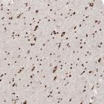 HP1 alpha Antibody in Immunohistochemistry (Paraffin) (IHC (P))