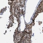 HP1 alpha Antibody in Immunohistochemistry (Paraffin) (IHC (P))