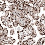 HP1 alpha Antibody in Immunohistochemistry (Paraffin) (IHC (P))