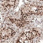 HP1 alpha Antibody in Immunohistochemistry (Paraffin) (IHC (P))