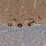 PPM1B Antibody in Immunohistochemistry (Paraffin) (IHC (P))