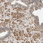 PPM1B Antibody in Immunohistochemistry (Paraffin) (IHC (P))