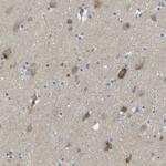 LIPG Antibody in Immunohistochemistry (Paraffin) (IHC (P))