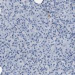 TGFBI Antibody in Immunohistochemistry (Paraffin) (IHC (P))