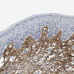 TGFBI Antibody in Immunohistochemistry (Paraffin) (IHC (P))