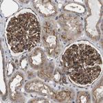 BST-2 Antibody in Immunohistochemistry (Paraffin) (IHC (P))