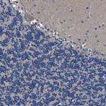 B7-H3 Antibody in Immunohistochemistry (Paraffin) (IHC (P))