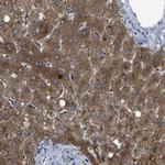 HFE Antibody in Immunohistochemistry (Paraffin) (IHC (P))