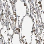 HFE Antibody in Immunohistochemistry (Paraffin) (IHC (P))