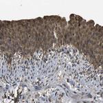 HFE Antibody in Immunohistochemistry (Paraffin) (IHC (P))