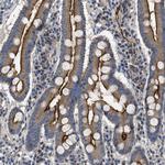 CD73 Antibody in Immunohistochemistry (Paraffin) (IHC (P))