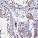 Bi-1 Antibody in Immunohistochemistry (Paraffin) (IHC (P))