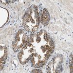 CaMKK beta Antibody in Immunohistochemistry (Paraffin) (IHC (P))