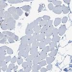 CaMKK beta Antibody in Immunohistochemistry (Paraffin) (IHC (P))