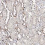 MGAT1 Antibody in Immunohistochemistry (Paraffin) (IHC (P))