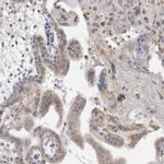 MGAT1 Antibody in Immunohistochemistry (Paraffin) (IHC (P))