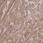 Cardiac Troponin T Antibody in Immunohistochemistry (Paraffin) (IHC (P))