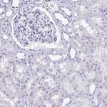 Cardiac Troponin T Antibody in Immunohistochemistry (Paraffin) (IHC (P))