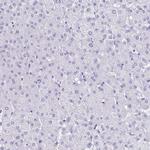 Cardiac Troponin T Antibody in Immunohistochemistry (Paraffin) (IHC (P))