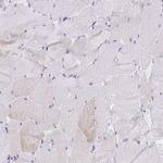 Cardiac Troponin T Antibody in Immunohistochemistry (Paraffin) (IHC (P))