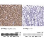 Cardiac Troponin T Antibody