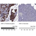 AAK1 Antibody