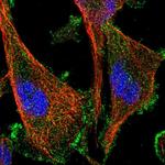 AAK1 Antibody in Immunocytochemistry (ICC/IF)