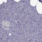 AAK1 Antibody in Immunohistochemistry (Paraffin) (IHC (P))