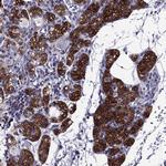 AAK1 Antibody in Immunohistochemistry (Paraffin) (IHC (P))