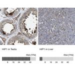 HIP1 Antibody