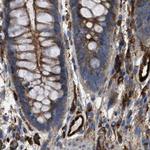 HIP1 Antibody in Immunohistochemistry (Paraffin) (IHC (P))