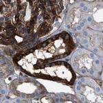 HIP1 Antibody in Immunohistochemistry (Paraffin) (IHC (P))