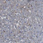 HIP1 Antibody in Immunohistochemistry (Paraffin) (IHC (P))