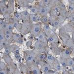 HIP1 Antibody in Immunohistochemistry (Paraffin) (IHC (P))