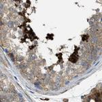 HIP1 Antibody in Immunohistochemistry (Paraffin) (IHC (P))