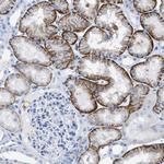 CD98 Antibody in Immunohistochemistry (Paraffin) (IHC (P))