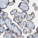 CD98 Antibody in Immunohistochemistry (Paraffin) (IHC (P))