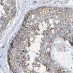 CD98 Antibody in Immunohistochemistry (Paraffin) (IHC (P))