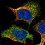 IFNAR1 Antibody in Immunocytochemistry (ICC/IF)