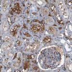 IFNAR1 Antibody in Immunohistochemistry (Paraffin) (IHC (P))