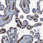 IFNAR1 Antibody in Immunohistochemistry (Paraffin) (IHC (P))